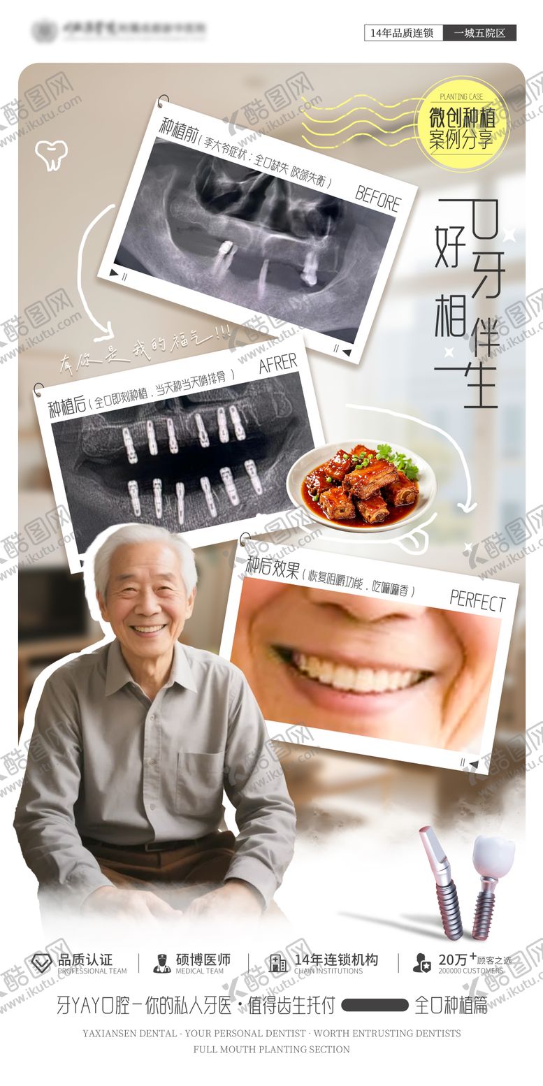 编号：88357210262040506794【酷图网】源文件下载-口腔种植案例海报
