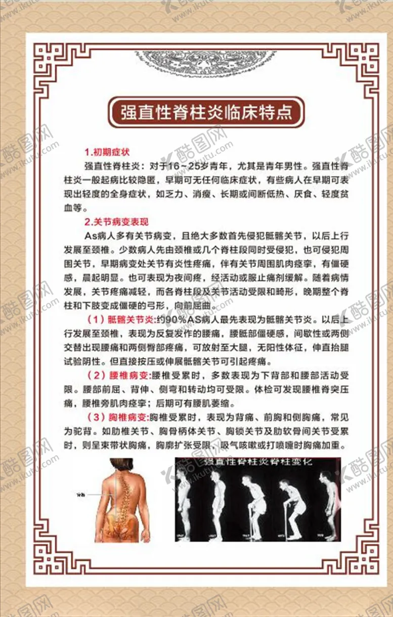 编号：25609803250741353030【酷图网】源文件下载-强直性脊柱炎