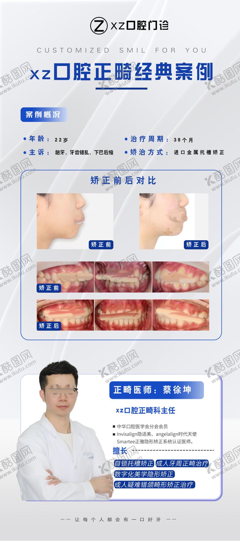 编号：21284006291714099915【酷图网】源文件下载-正畸案例展架