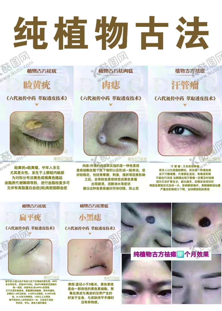 编号：42359809182134073965【酷图网】源文件下载-纯植物古法去痣
