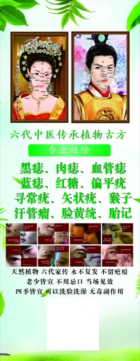点痣展架