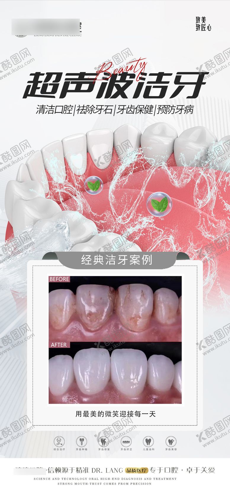 编号：44915410032221436703【酷图网】源文件下载-口腔超声波洁牙案例对比海报