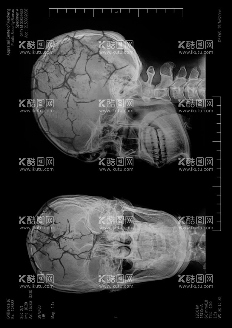 编号：19485512040037534884【酷图网】源文件下载-X光