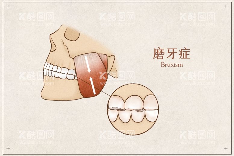 编号：94731812251029057784【酷图网】源文件下载-磨牙症