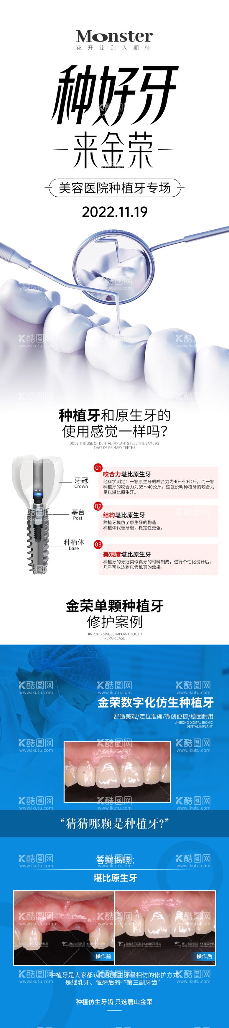 编号：63878911191547298617【酷图网】源文件下载-医美种植牙专题