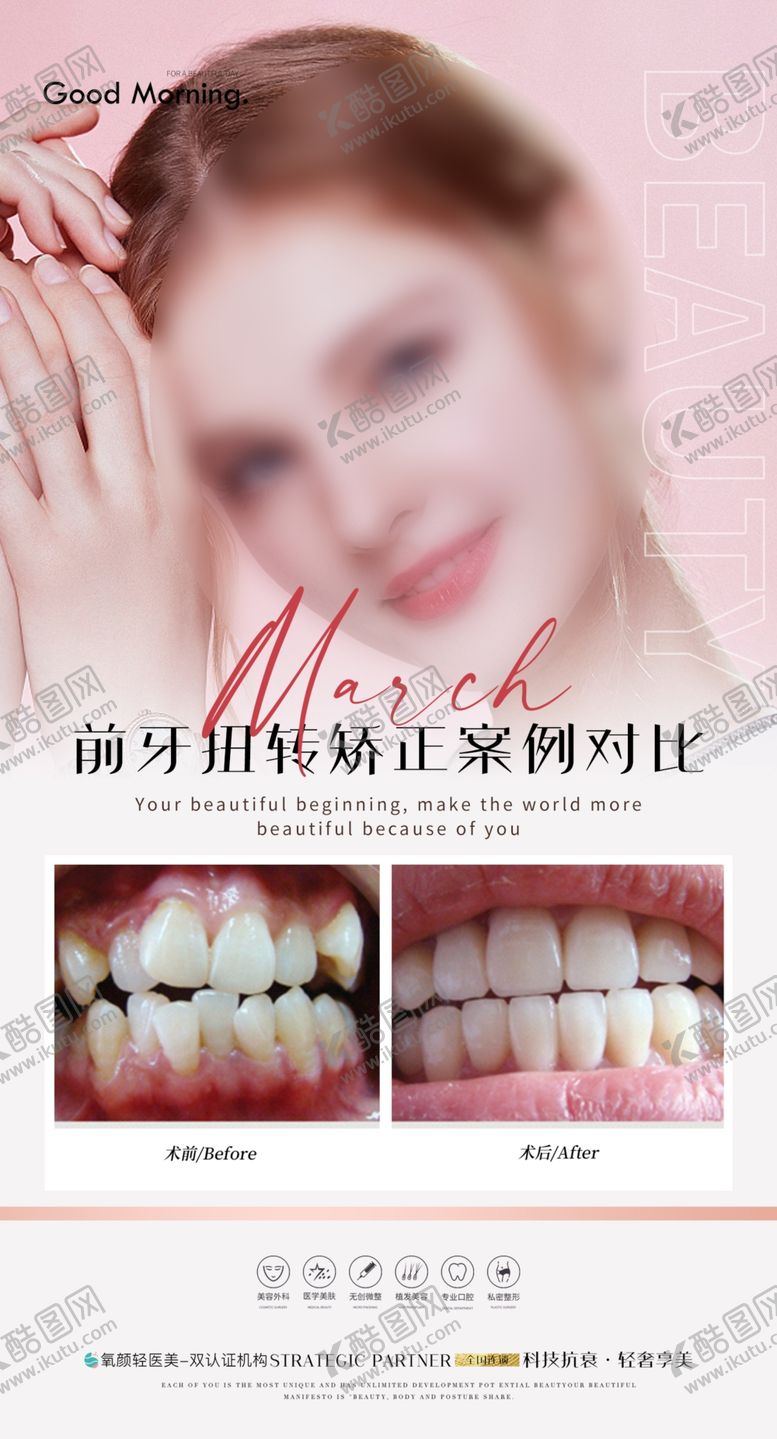 编号：28510309180034415813【酷图网】源文件下载-牙齿矫正案例