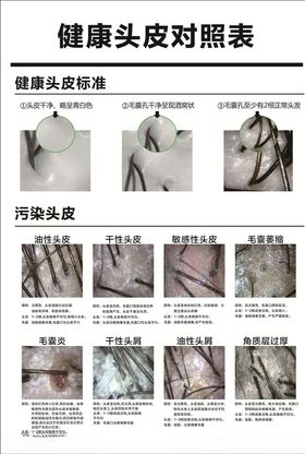 头皮对照表