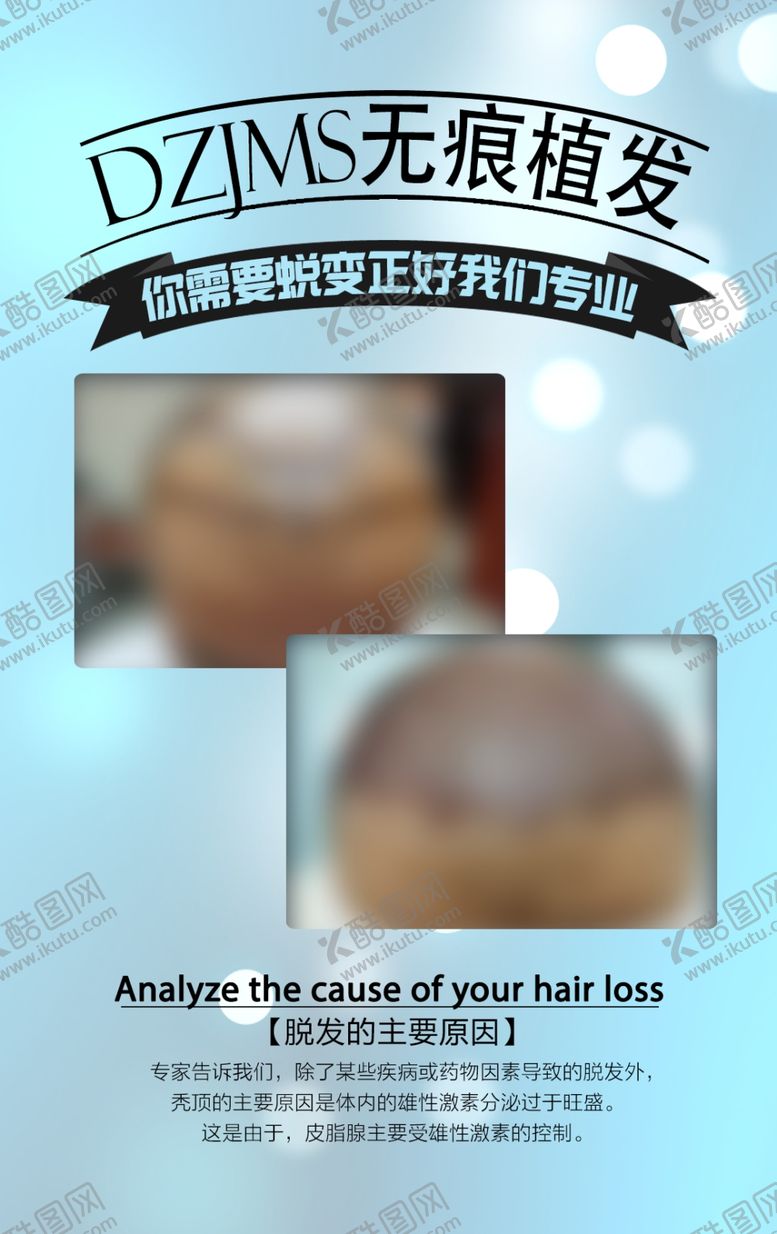 编号：94923007060631595092【酷图网】源文件下载-植发