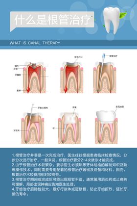 什么是根管治疗