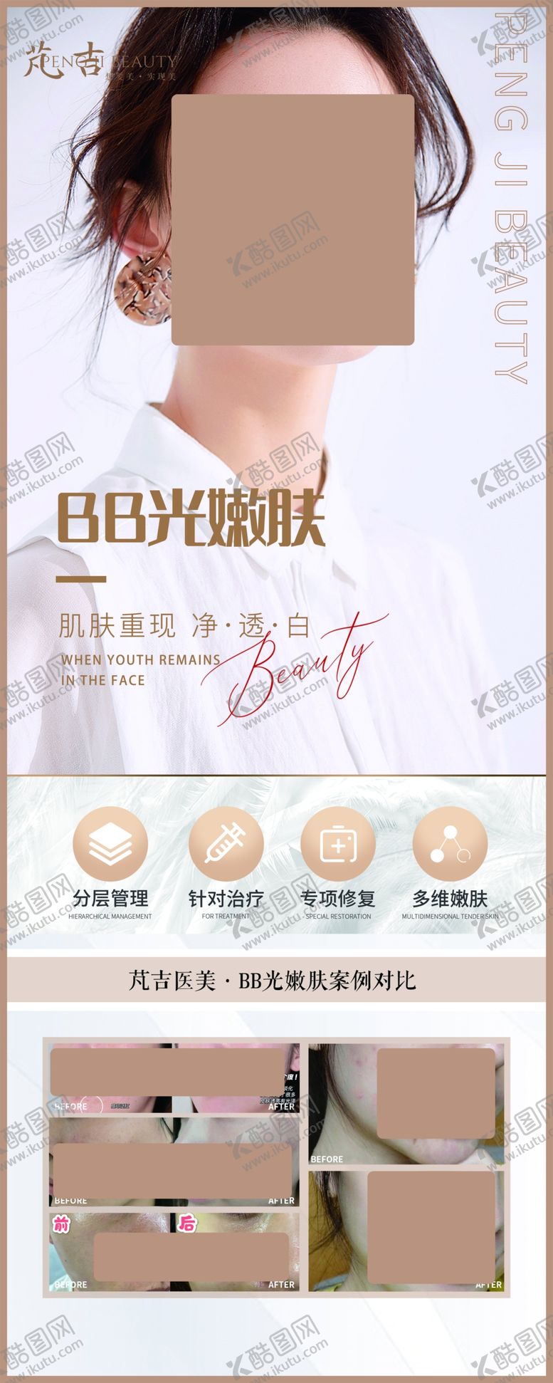编号：84167010072205490895【酷图网】源文件下载-光子嫩肤案例对比医美整形医院