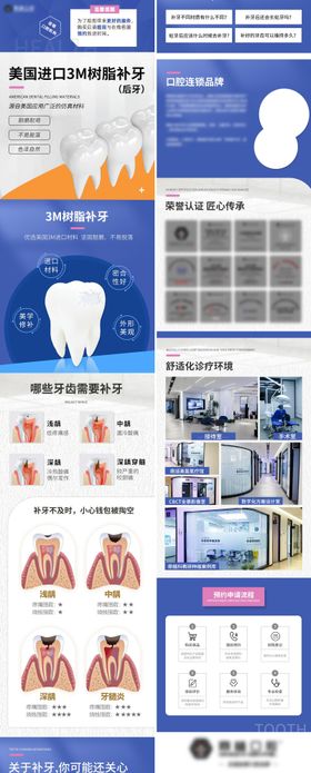 美国进口3M树脂补牙