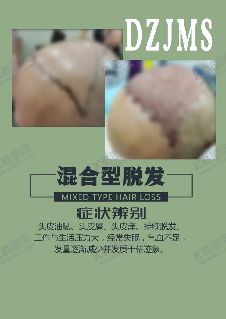 编号：17473406281426294469【酷图网】源文件下载-植发案例
