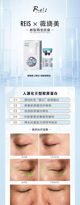 医美 | 薇旖美产品海报
