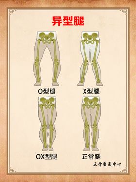 正骨海报