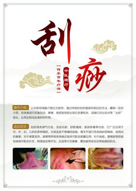刮痧