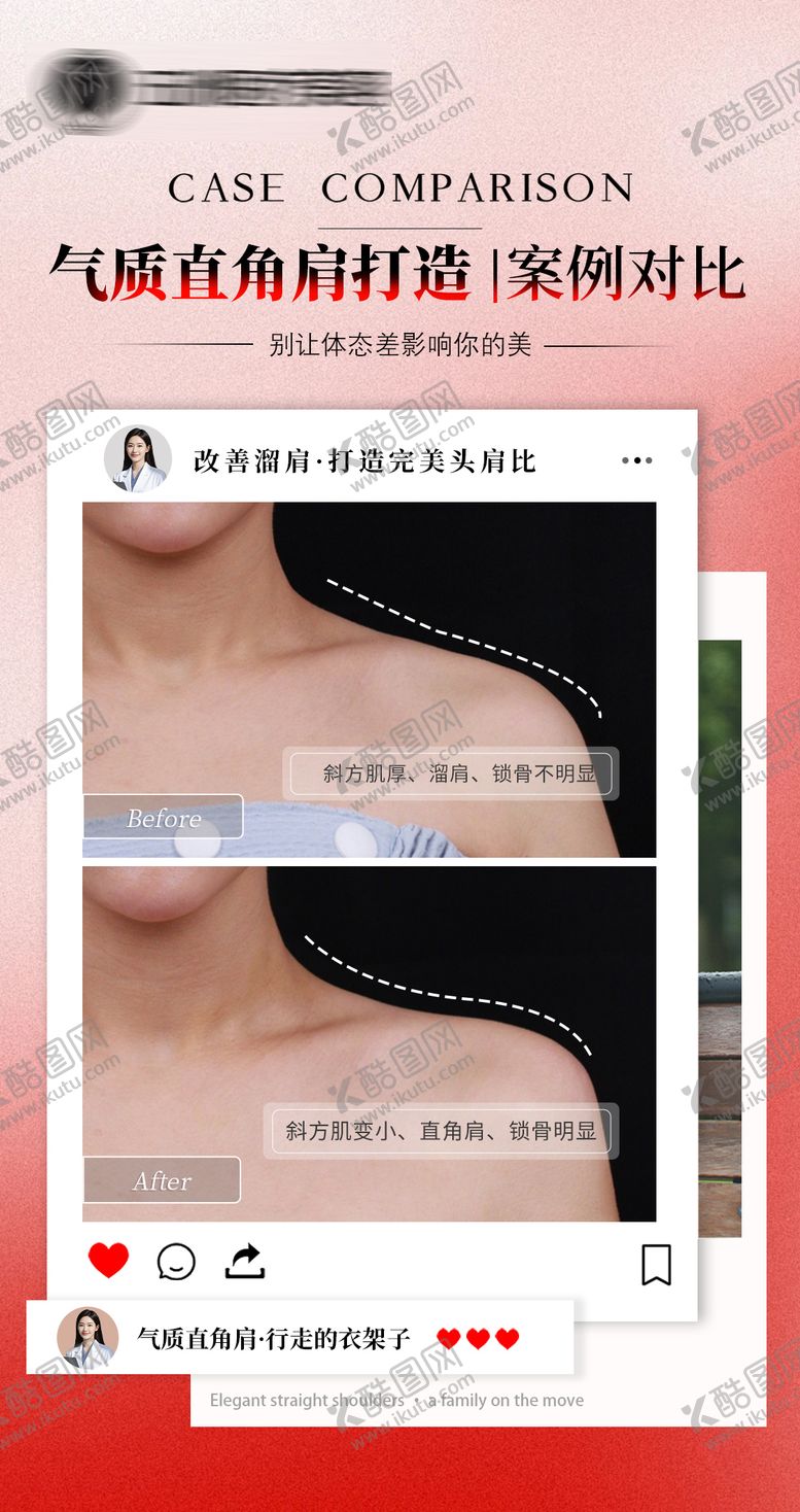 编号：65859804142335198934【酷图网】源文件下载-医美案例对比