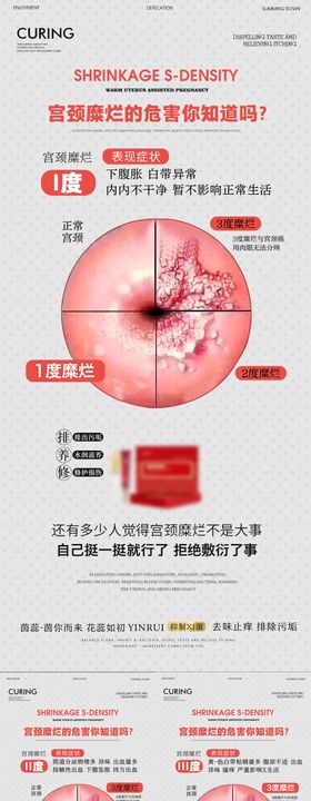 宫颈糜烂的危害你知道吗？