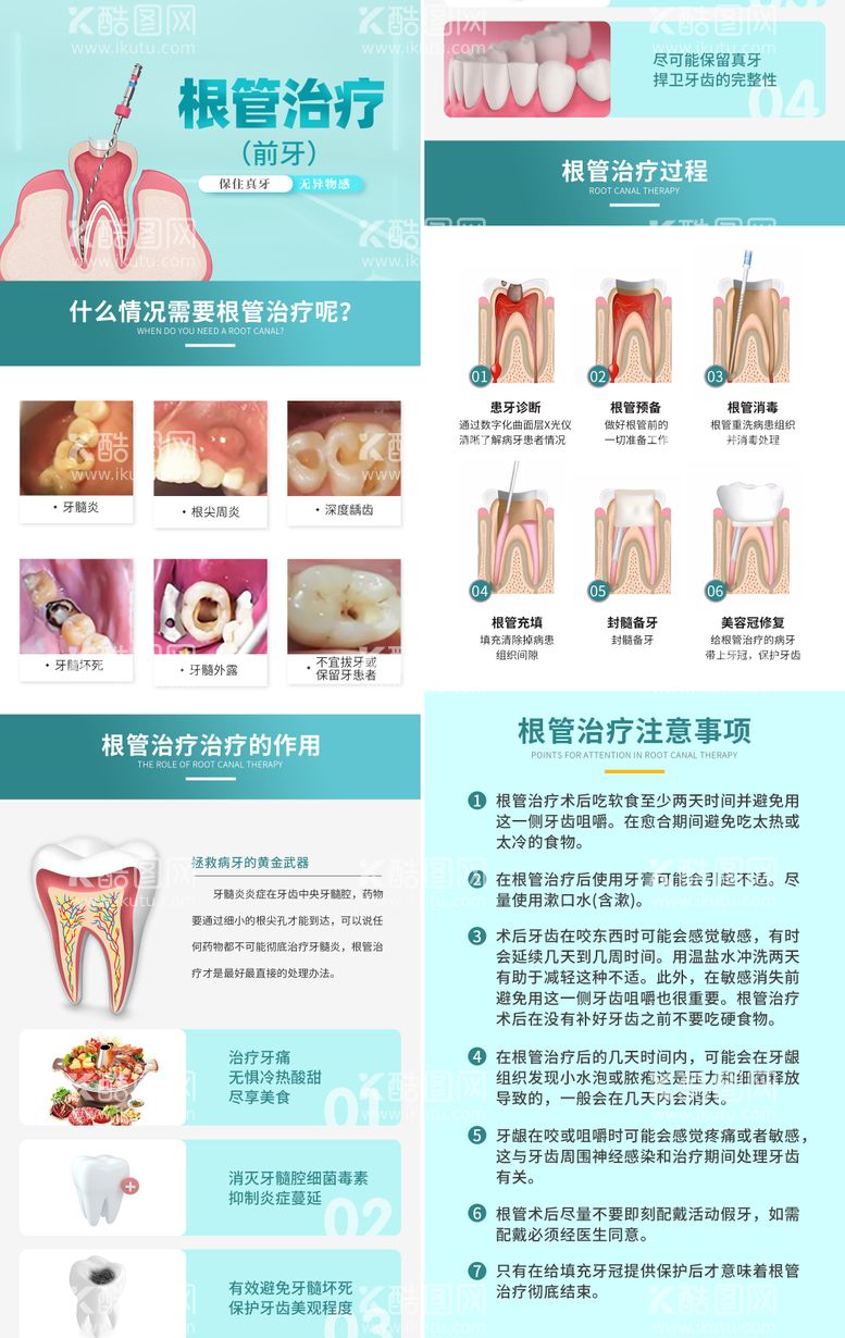 编号：27594211240959202904【酷图网】源文件下载-根管治疗详情页