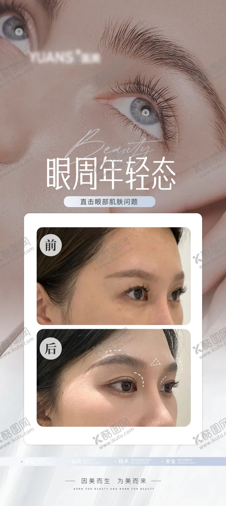 编号：88824012060153298510【酷图网】源文件下载-医美眼周眼睛案例