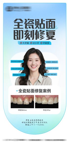 全瓷贴面案例海报