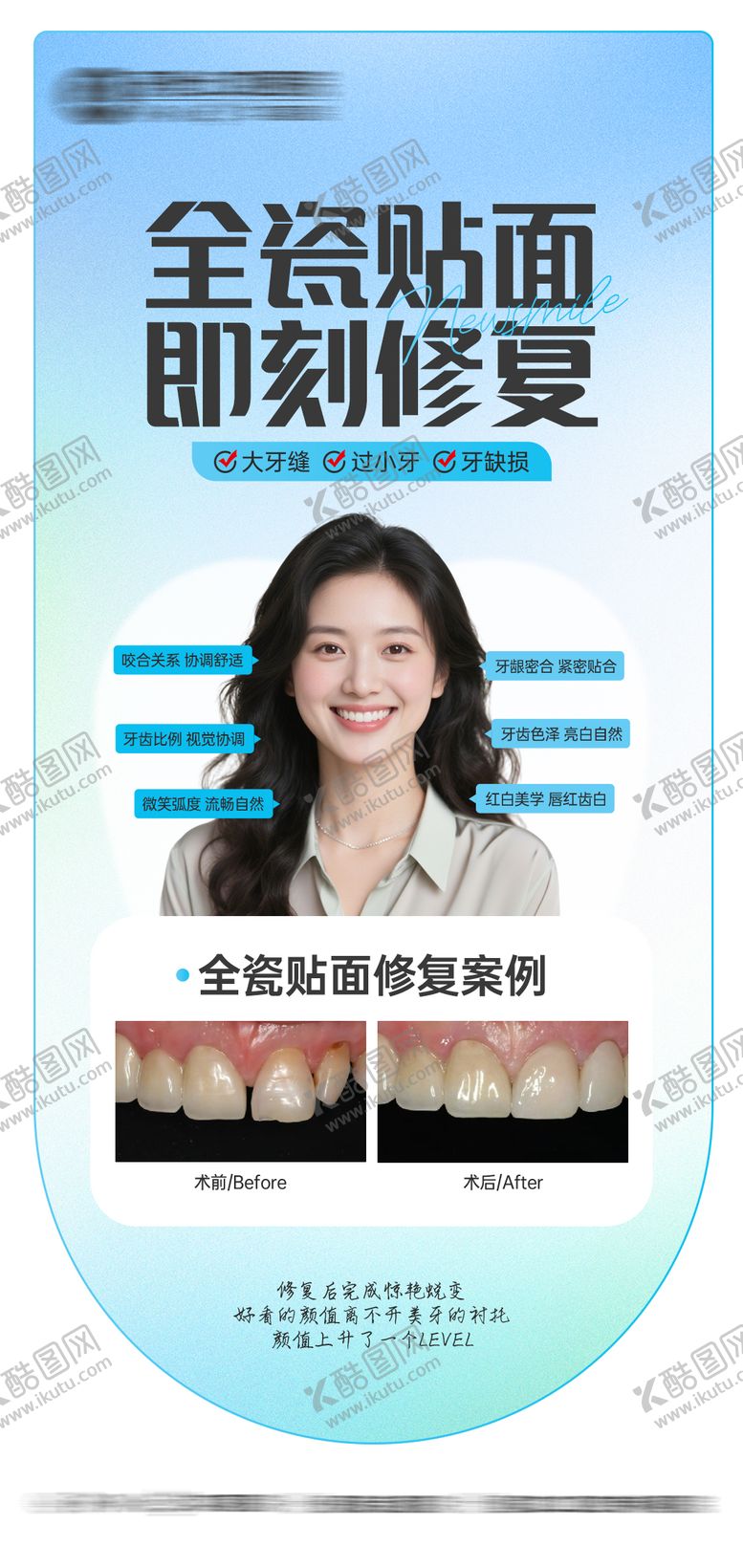 编号：30198801292006205862【酷图网】源文件下载-全瓷贴面案例海报