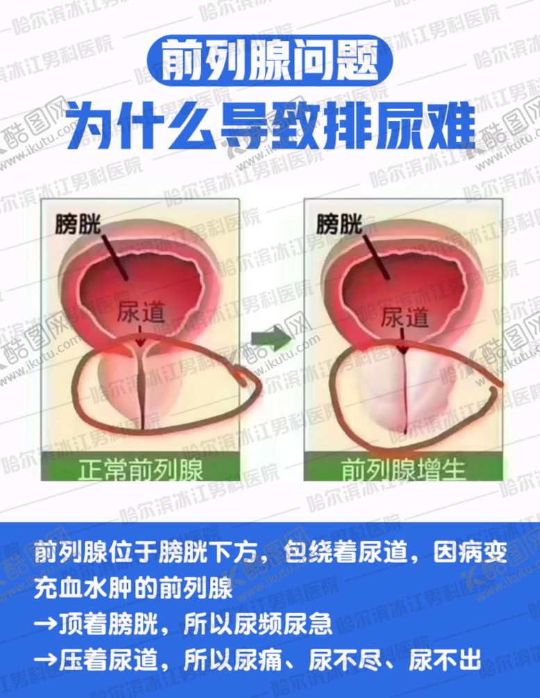 编号：57103910141541599803【酷图网】源文件下载-男科常识