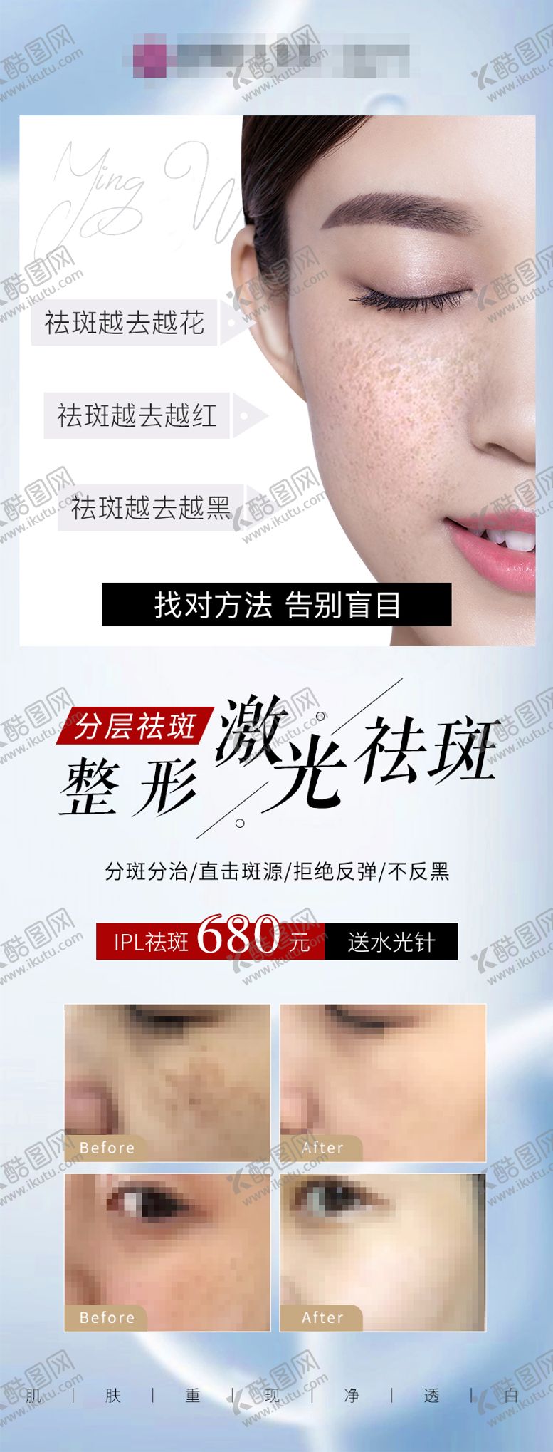 编号：88468411160321027623【酷图网】源文件下载-美容祛斑海报