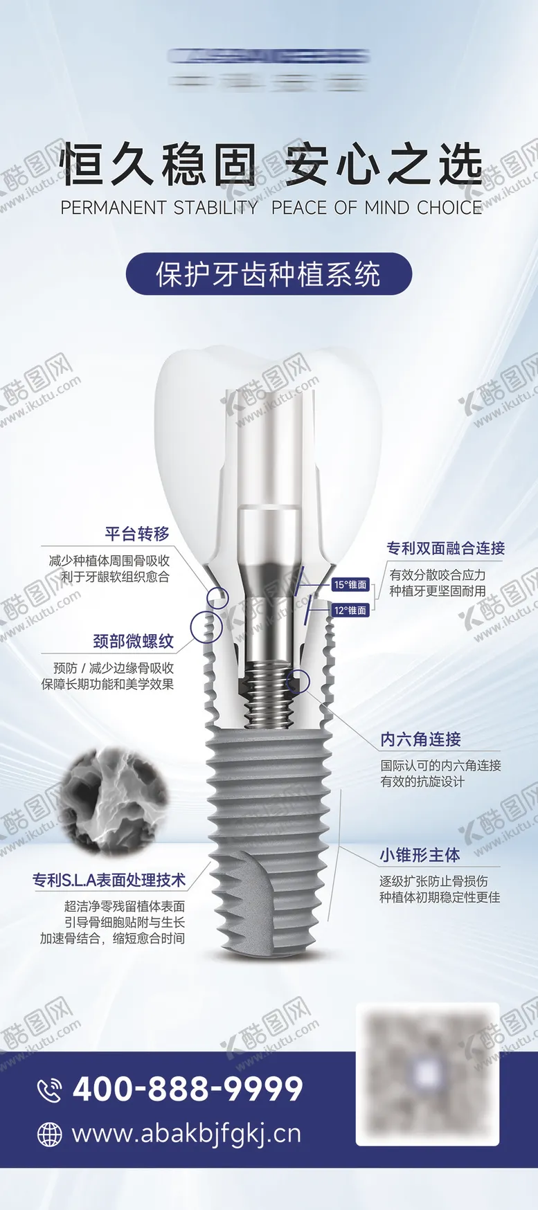 编号：34660106151153546421【酷图网】源文件下载-口腔种植牙植体介绍展架