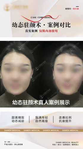 医美整形幼态脸案例对比