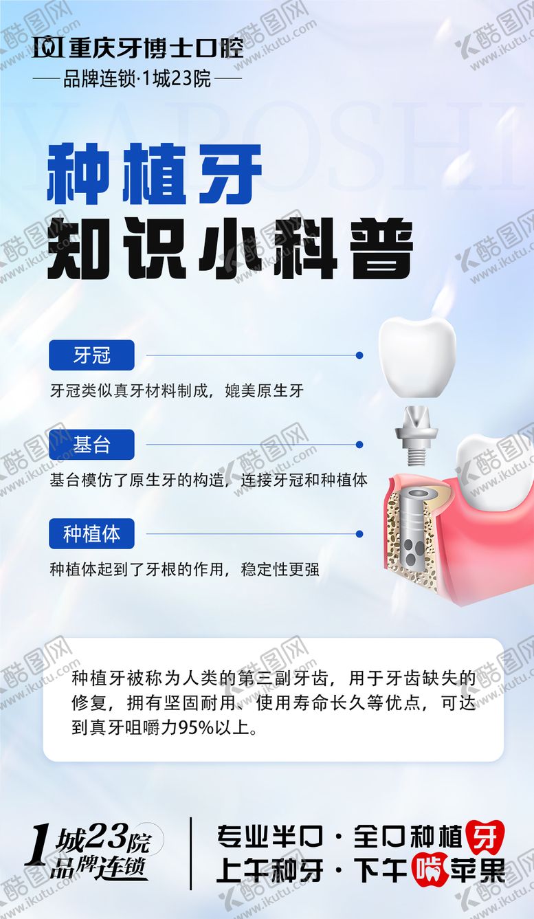 编号：31980105181508179591【酷图网】源文件下载-种植牙科普小知识