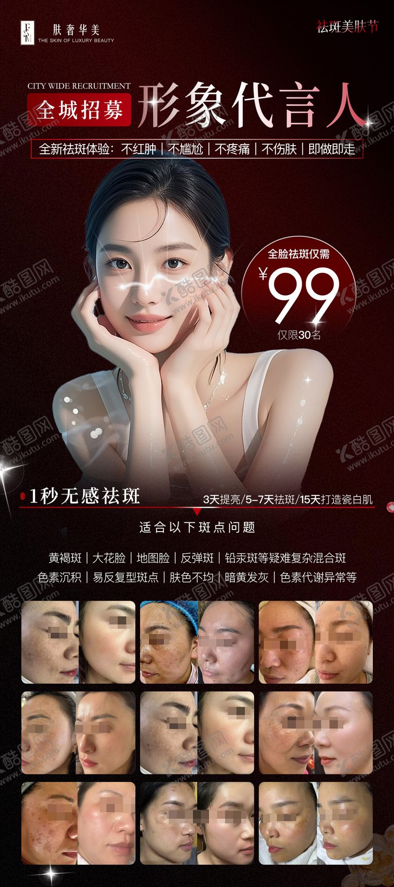 编号：42970009172132103436【酷图网】源文件下载-祛斑活动海报