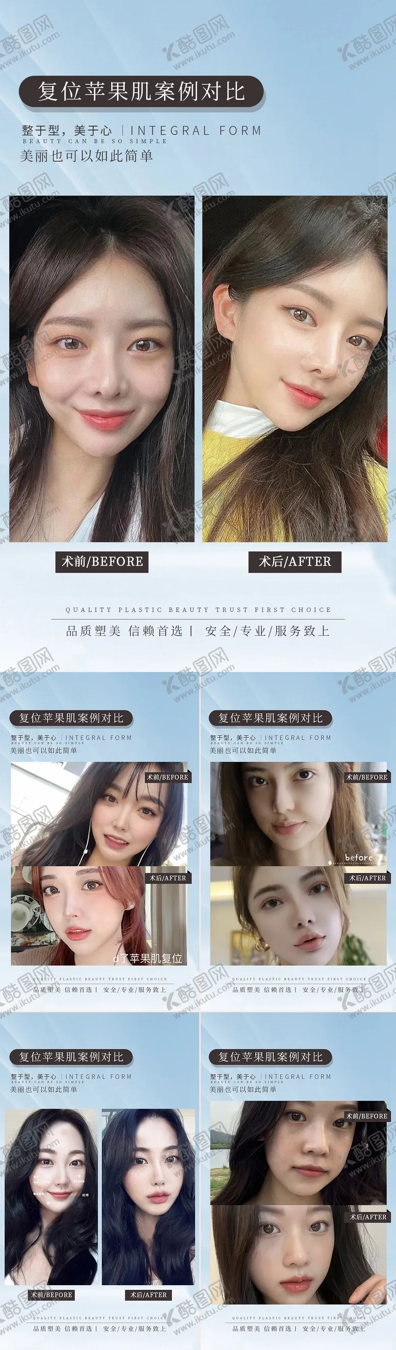 编号：45832411230513194277【酷图网】源文件下载-医美复苹果肌案例对比海报