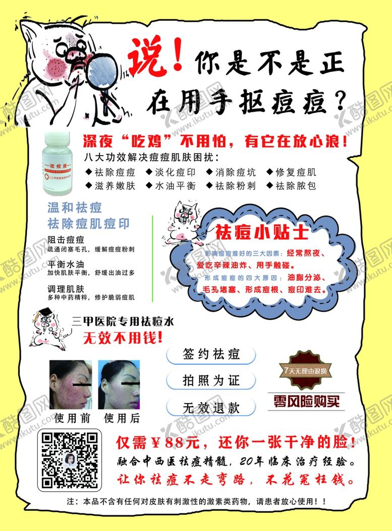 编号：20958010080600148189【酷图网】源文件下载-祛痘宣传单