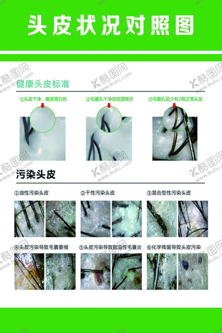 编号：56958812141434311959【酷图网】源文件下载-头皮状况对照图