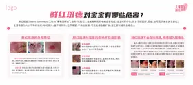 医院胎记科普