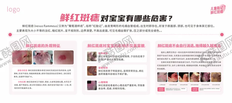 编号：29796206171642276522【酷图网】源文件下载-医院胎记科普