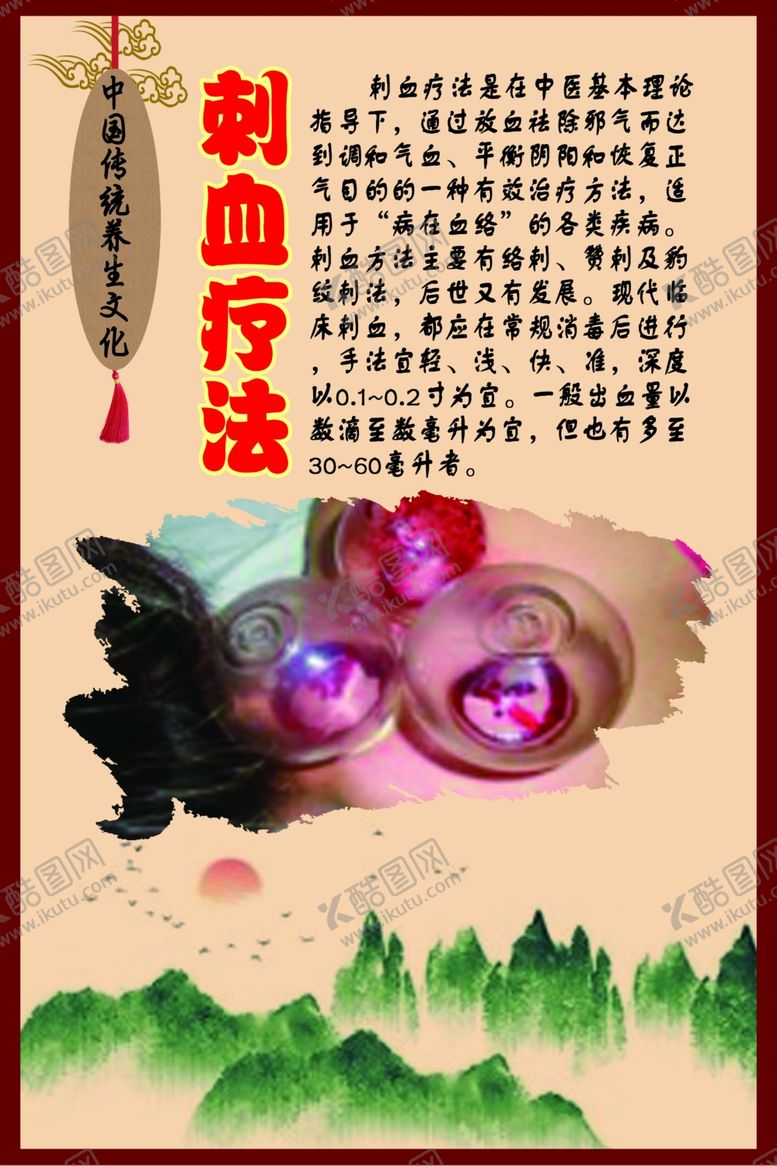 编号：88273809210319186906【酷图网】源文件下载-中华传统养生文化之刺血疗法
