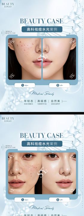 医美对比图