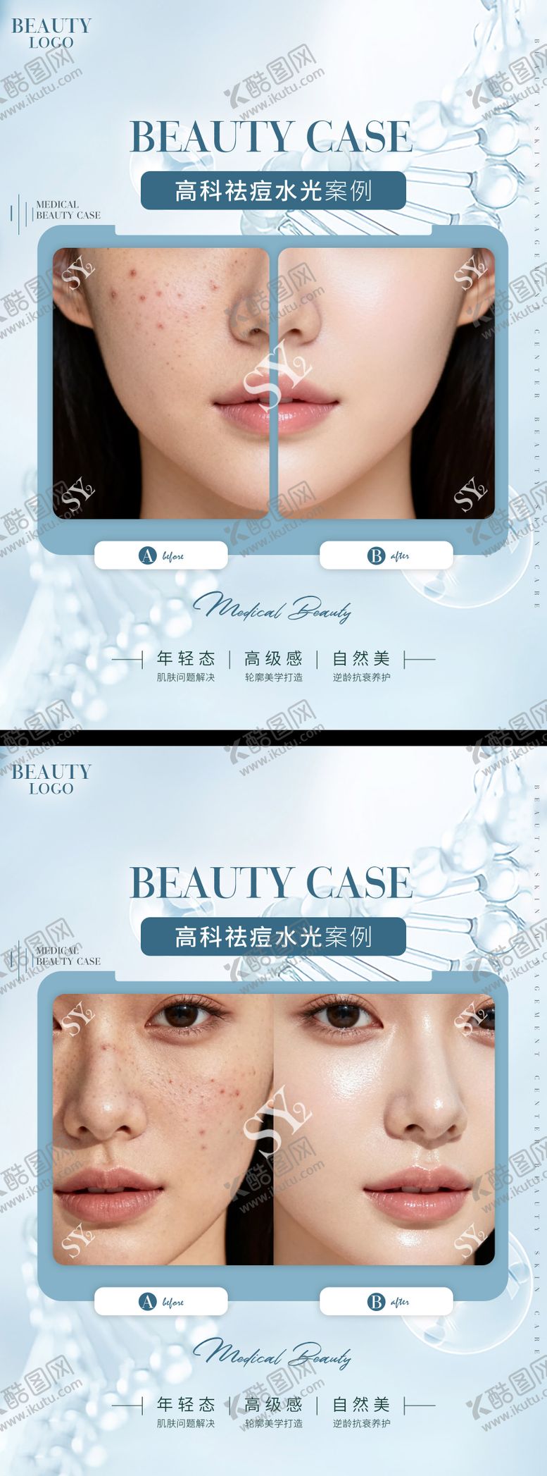 编号：76718210242204215339【酷图网】源文件下载-医美对比图 