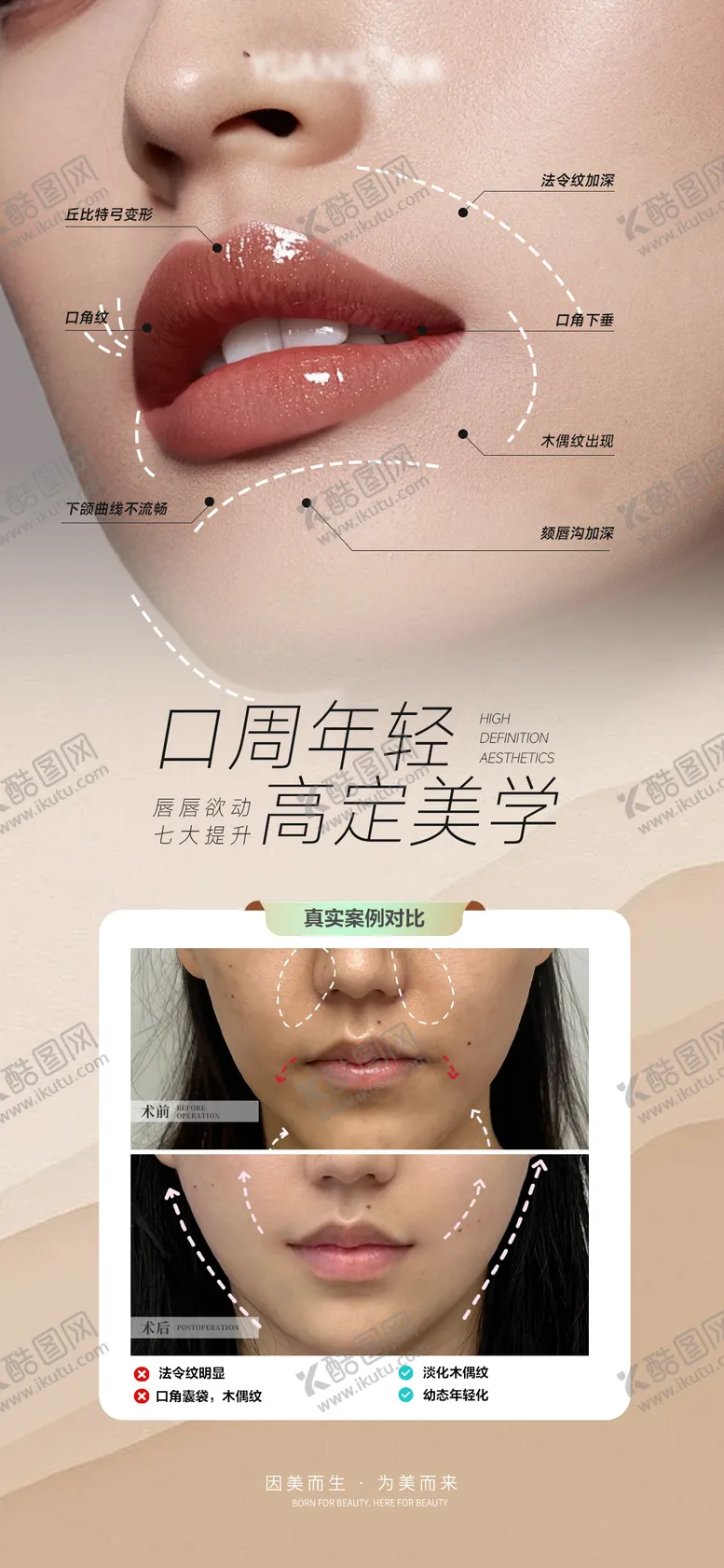 编号：60418204221805132757【酷图网】源文件下载-医美口周案例对比图