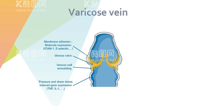 编号：93373412231925174183【酷图网】源文件下载-静脉曲张 