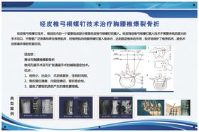 经皮肝穿刺射频消融术治疗肝癌