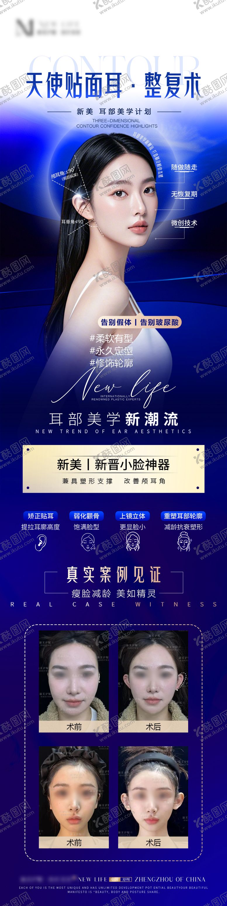 编号：39781212101409498525【酷图网】源文件下载-医美品相精灵耳宣传长图海报