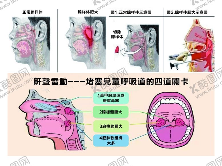 编号：88107209252208037298【酷图网】源文件下载-鼾聲雷動