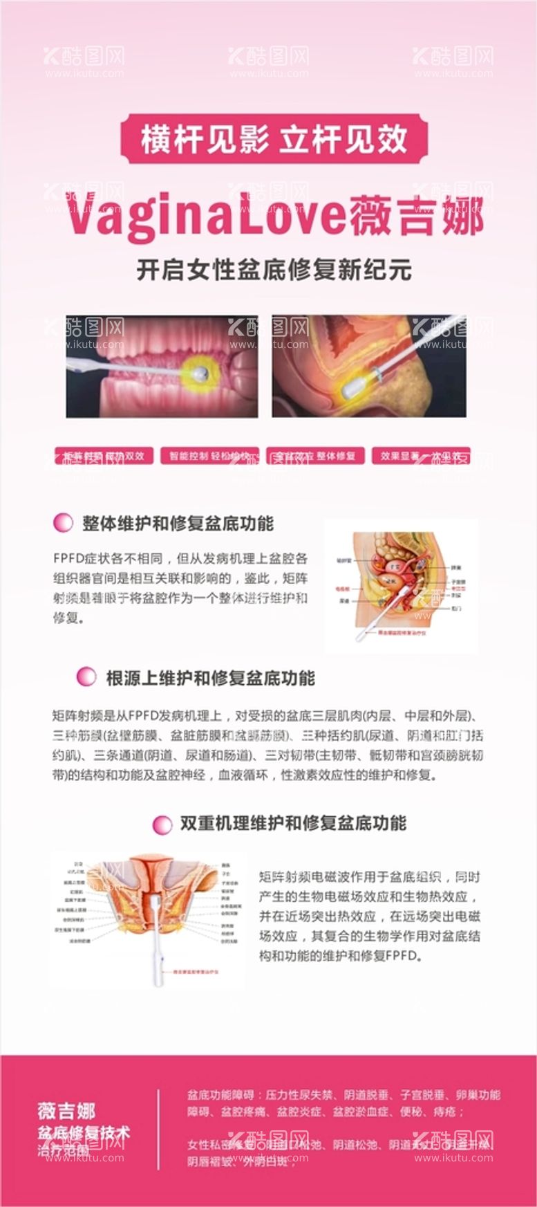 编号：19685211271409303305【酷图网】源文件下载-妇科盆底修复治疗技术宣传展架