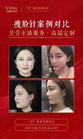 医美整形医院宣传单海报模板