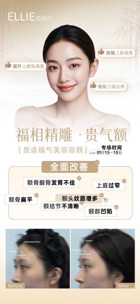 医美东方美学-贵气额海报