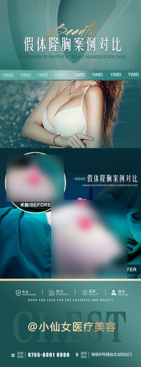 医美丰胸案例系列海报