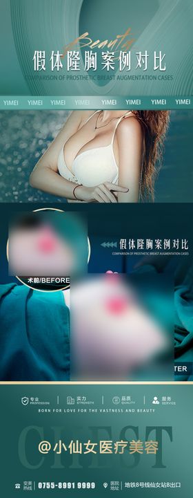 医美动感丰胸案例海报