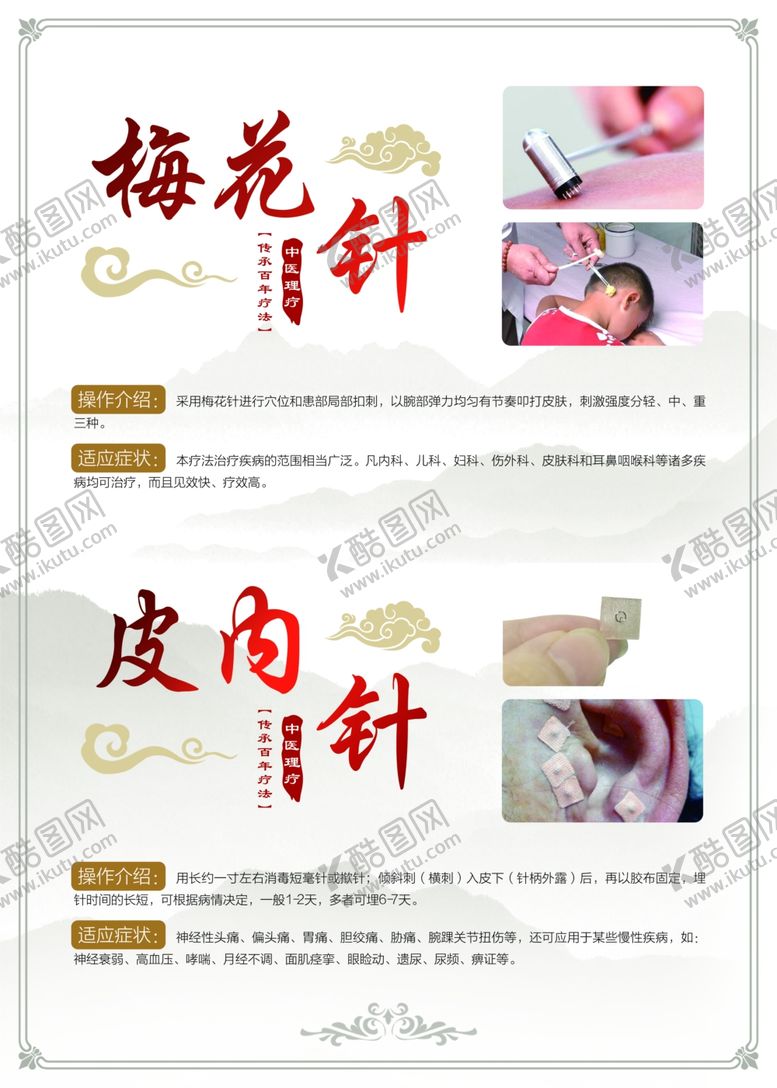 编号：85537203120658215564【酷图网】源文件下载-梅花针皮内针